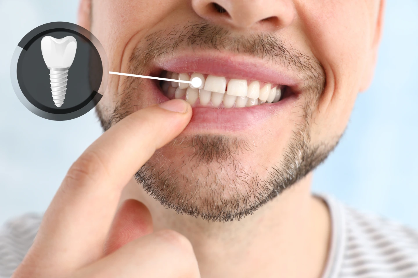 Dentist showing a patient a model of a dental implant in Granada Hills, CA
