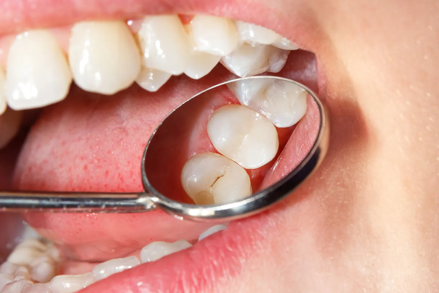 Preventive Dentistry
