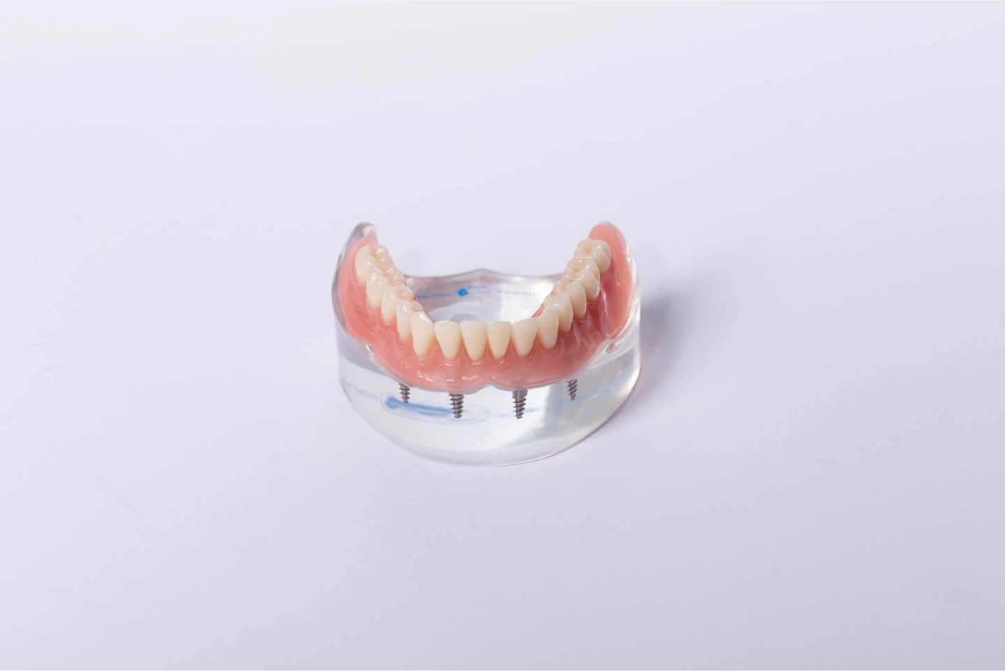 Removable Dental Appliances