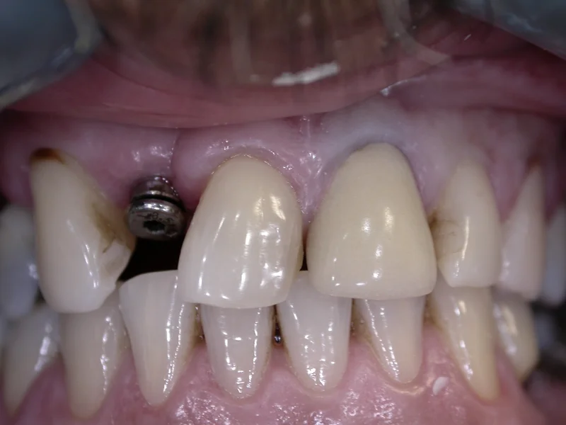 Actual Patient before Cosmetic Dentistry