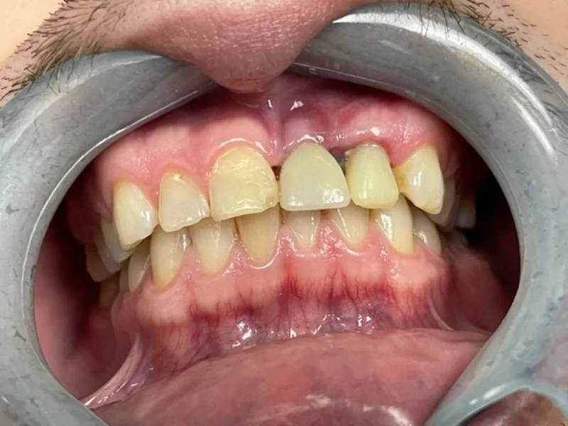 Actual Patient before Cosmetic Dentistry