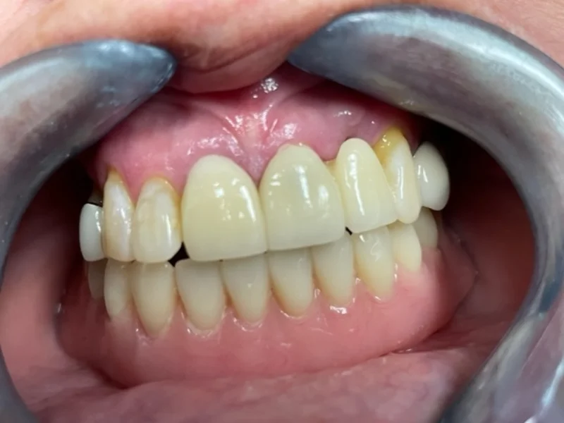 Actual Patient after Cosmetic Dentistry
