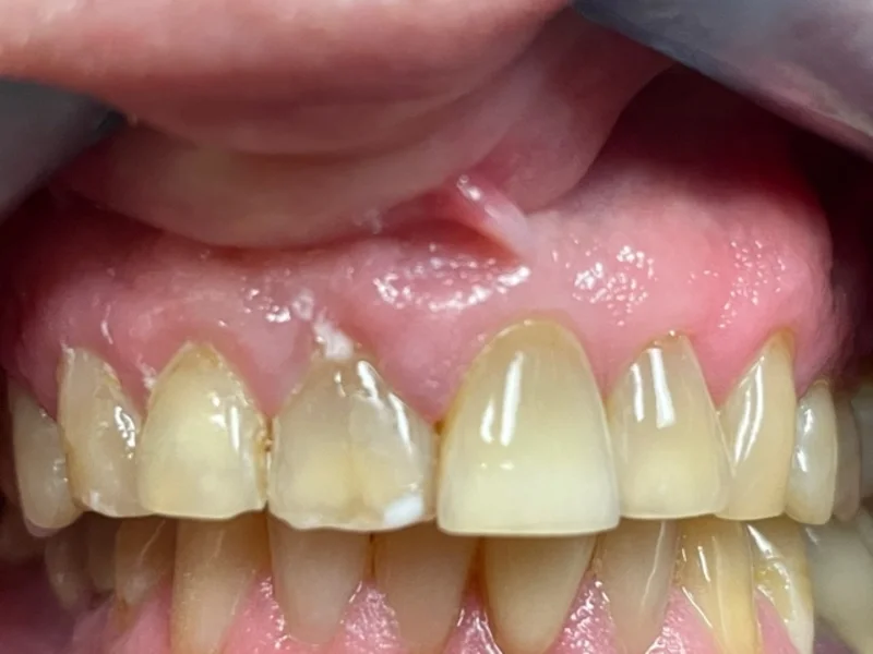 Actual Patient before Cosmetic Dentistry